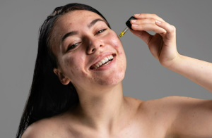 A girl applying salicylic acid to her skin 